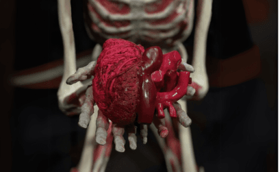 HDL za wysoki. Wysoki poziom HDL przyczyny. Wysoki HDL co oznacza? Wysoki cholesterol HDL